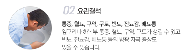 요로결석 이미지2