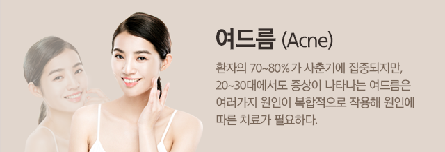 여드름 타이틀 이미지